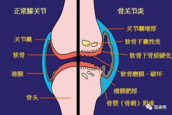 膝关节