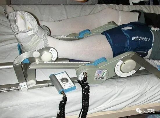 cpm康复器怎么拼写CPM机的优缺点_https://www.jmylbn.com_新闻资讯_第1张