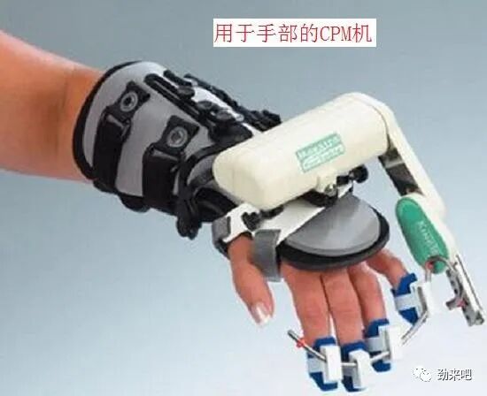 cpm康复器怎么拼写CPM机的优缺点_https://www.jmylbn.com_新闻资讯_第5张
