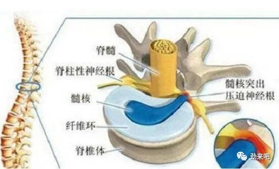 怎么选择家用颈椎牵引颈椎牵引的角度、力度和时间_https://www.jmylbn.com_新闻资讯_第1张
