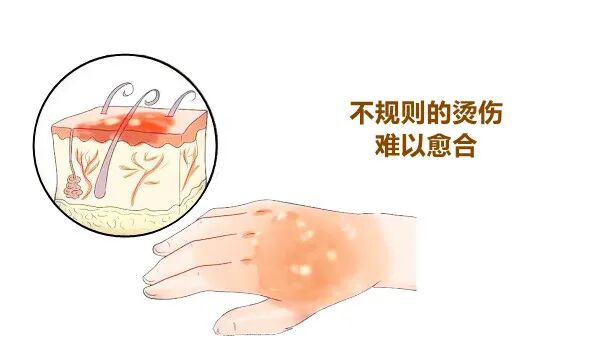 医用消疤贴怎么用大白话说中医第五百八十四期｜秦艽加上白僵蚕，祛斑消疤不麻烦_https://www.jmylbn.com_新闻资讯_第18张