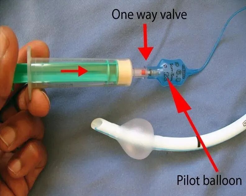医用气管有哪些7个常规气管导管结构细节和6种特殊类型的气管导管_https://www.jmylbn.com_新闻资讯_第8张