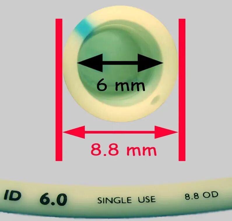 医用气管有哪些实用技术丨常规气管导管的7个结构细节&6种特殊类型的气管导管_https://www.jmylbn.com_新闻资讯_第5张