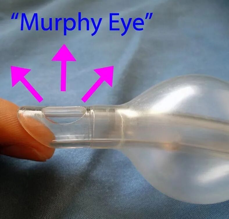 医用气管有哪些7个常规气管导管结构细节和6种特殊类型的气管导管_https://www.jmylbn.com_新闻资讯_第10张