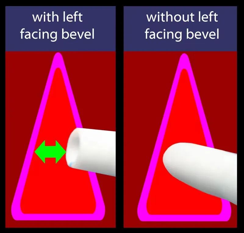医用气管有哪些7个常规气管导管结构细节和6种特殊类型的气管导管_https://www.jmylbn.com_新闻资讯_第11张