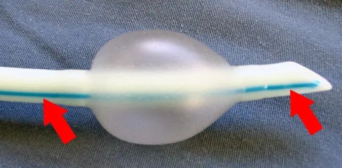 医用气管有哪些实用技术丨常规气管导管的7个结构细节&6种特殊类型的气管导管_https://www.jmylbn.com_新闻资讯_第4张