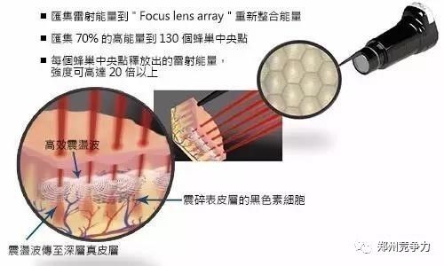 皮秒——斑斑点点,一扫而空! 皮秒——斑斑点点,一扫而空!