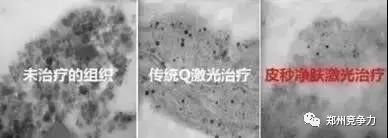 肤色匀净有光泽,抛弃美颜相机我们应该怎样做? 肤色匀净有光泽,抛弃美颜相机我们应该怎样做?