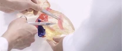 我国多家医院正加速“3D打印技术+医疗”落地！将给患者带来哪些利好？|视点深度