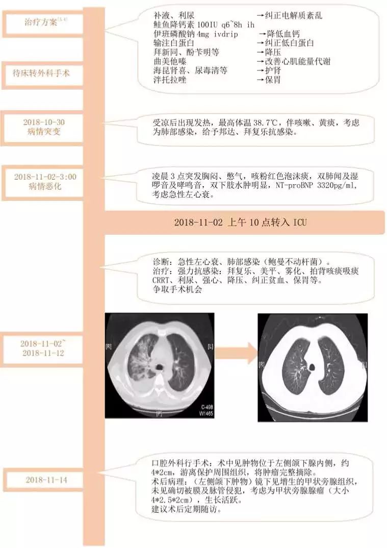 別拿高鈣血症不當回事兒 健康 第27張