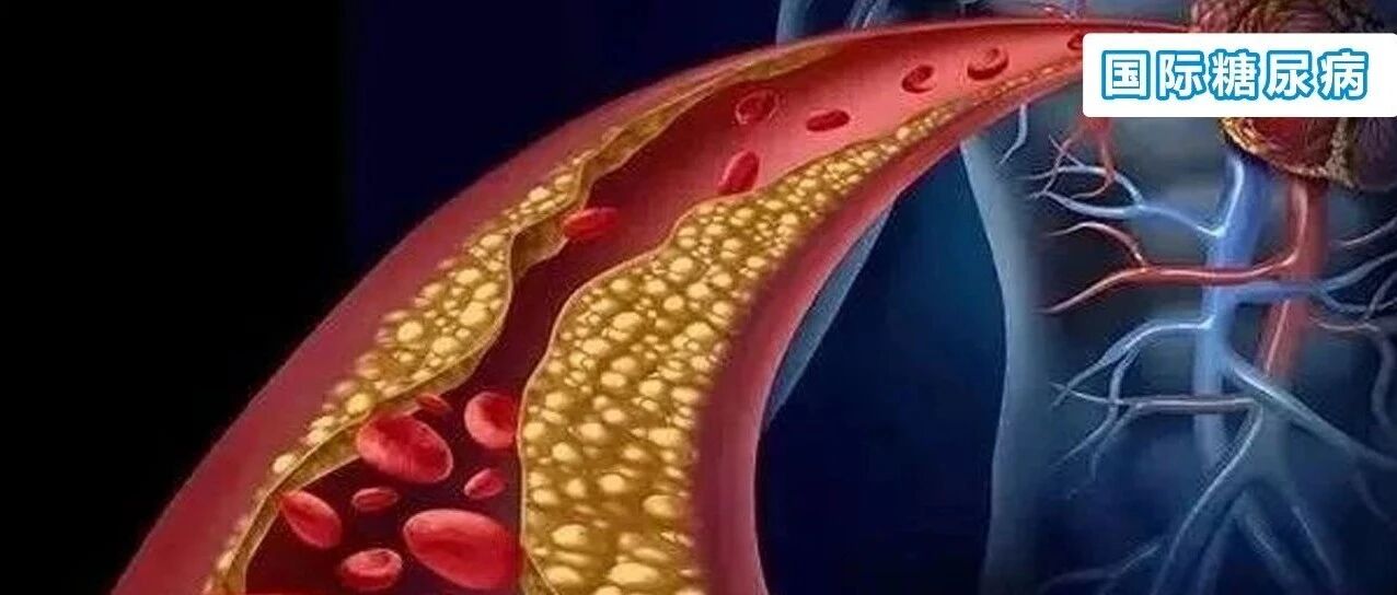 精“英”克糖 |2型糖尿病患者TIR与全因死亡和心血管死亡的关系