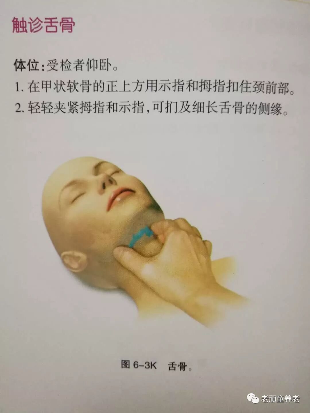 吞咽治疗仪怎么用吞咽障碍丨吞咽障碍电刺激治疗仪 Vital Stim 相关治疗细节_https://www.jmylbn.com_新闻资讯_第4张