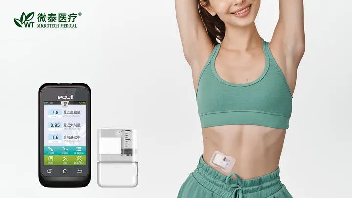 微泰胰岛素泵怎么样上市6年 ｜ 第一位泵用户首次现身，带你回顾那些闪亮的日子_https://www.jmylbn.com_新闻资讯_第9张