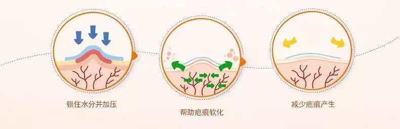 壳聚糖凝胶效果怎么样都在问的“擦伤／划伤／摔伤用什么不留疤”？答案来了_https://www.jmylbn.com_新闻资讯_第8张