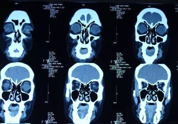 医用胶片怎么处理【收藏】医疗设备知识点整理_https://www.jmylbn.com_新闻资讯_第4张