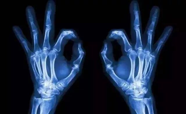 医用胶片怎么处理【收藏】医疗设备知识点整理_https://www.jmylbn.com_新闻资讯_第3张