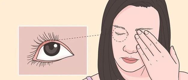 爬进眼睛的“不速之客”，会传染吗？