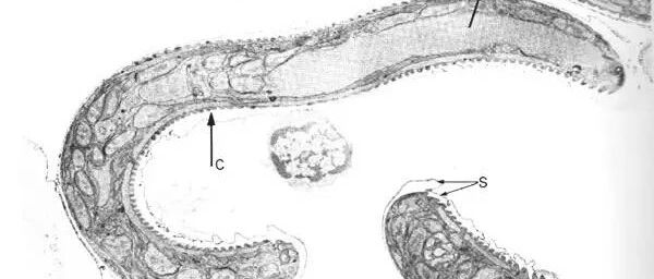 家里养这种宠物的注意啦，它是弓形虫的终极宿主，可能会影响孕妈和宝宝的健康！