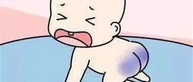 别觉得不好意思，这些关于“屁股”的健康知识，你最好还是知道一下！