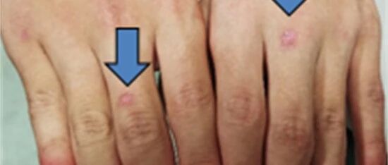 浙江丨男孩开心打水仗，下一秒他捂眼惨叫！众人一看慌了：他眼睛变得血淋淋…