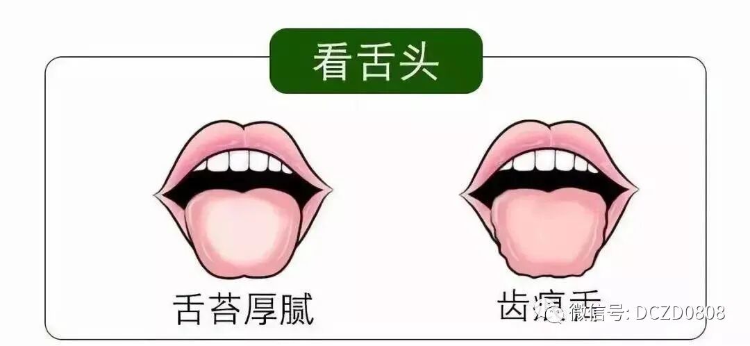 舌头两边锯齿状是什么原因