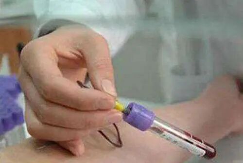 解读孕前需知的"优生密码"——TORCH优生五项！