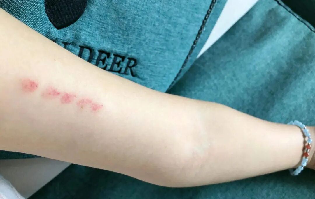 反复流产、难以受孕、试管婴儿屡次失败......居然与这个因素异常有关！