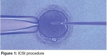 精液不液化，精子再多也枉然！精子不液化怎么成功当爸爸?