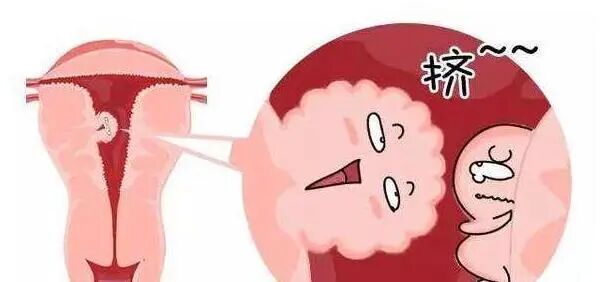 月经过多过少，也许是不孕的警告！