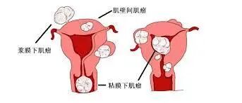 月经过多过少，也许是不孕的警告！