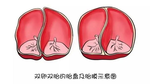 鲜胚还是冻胚？单胚还是多胚？胚胎移植你关心的都在这！