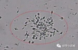 孕育课堂 | 如何预防备孕路上的7种免疫性不孕症？