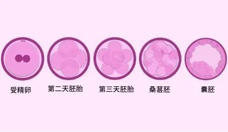 做试管婴儿，为何提倡采用选择性单囊胚移植?