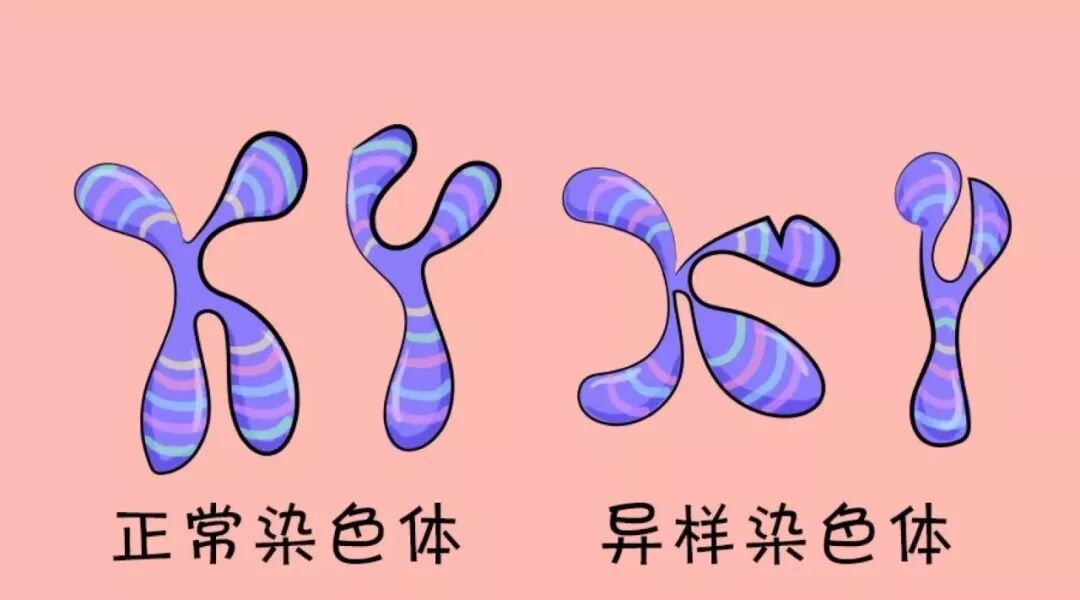 基因遗传疾病 | 畸形胎儿，该如何逆天改命？