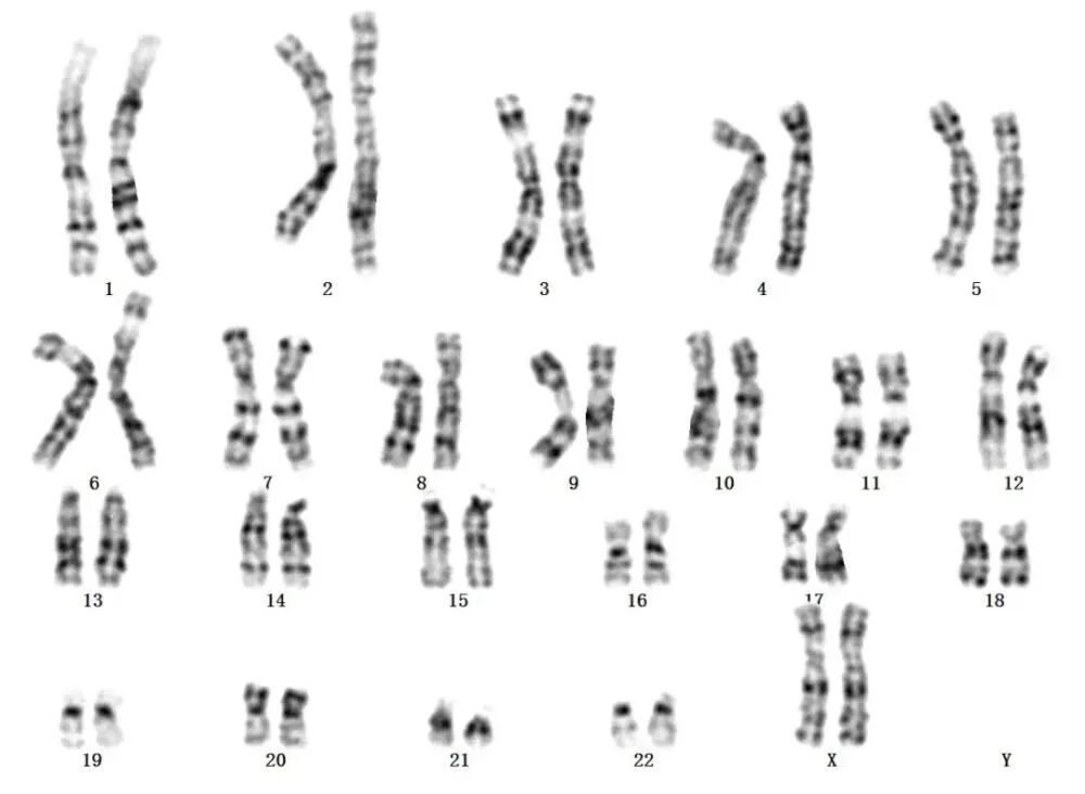 夫妻同床共枕5年，一觉醒来丈夫变“姐妹”！