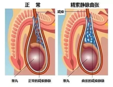 为精子"加油"的助孕好"帮手"，你get到了吗?
