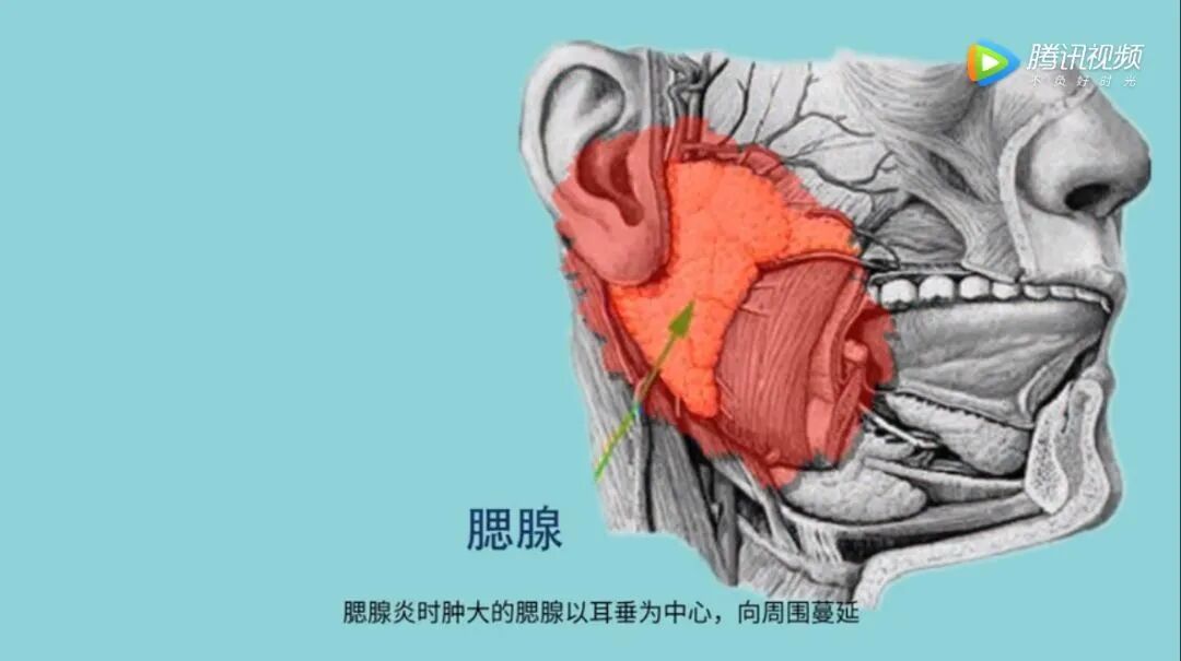 有些人不育，竟因小时候腮帮子疼？硬核科普腮腺炎和蛋蛋的秘密！