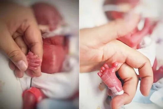 做第三代试管婴儿，为什么医生只让我移一个囊胚？