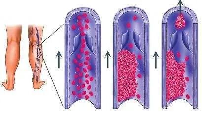 黄体酮只是用来保胎?那你有点低估它了！