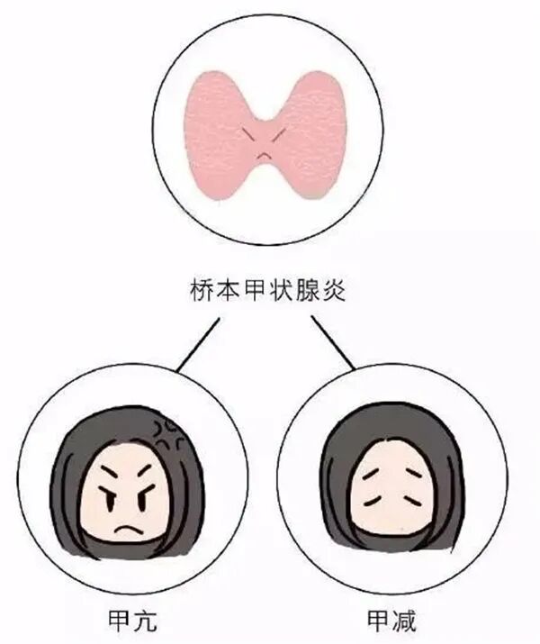 影响卵巢衰老的因素，女性都应该了解！