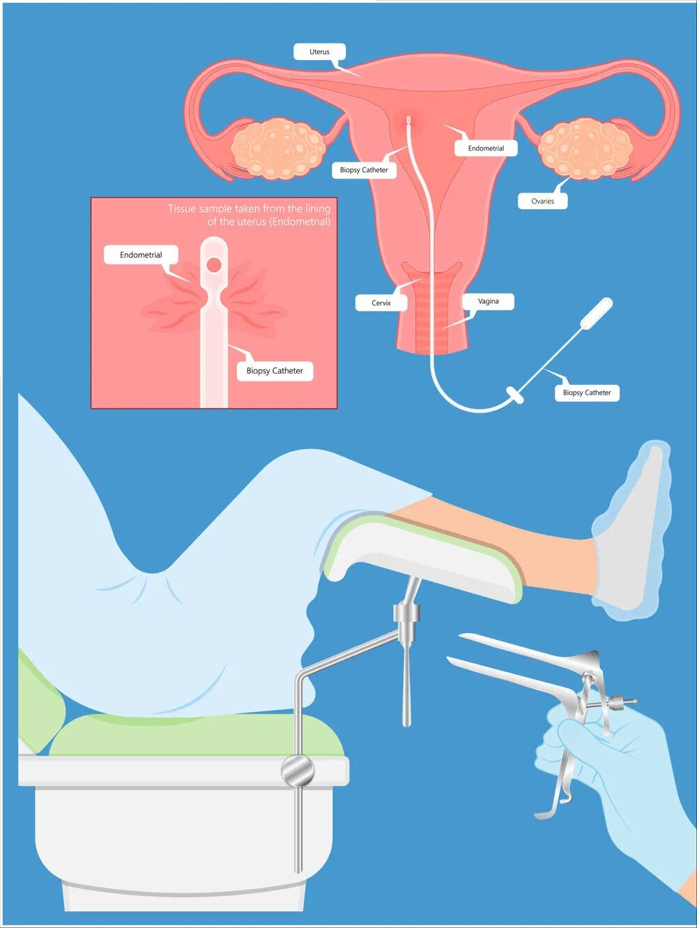 试管婴儿成功率高的秘密——把握胚胎移植“种植窗”!