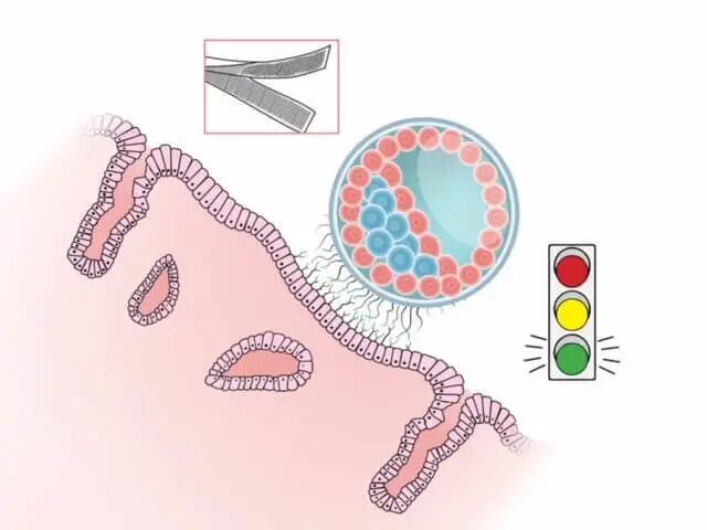 试管婴儿成功率高的秘密——把握胚胎移植“种植窗”!