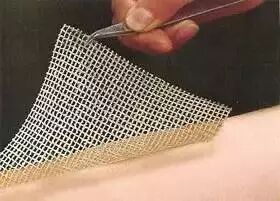 医用泡沫敷料怎么用常见的几种新型医用敷料_https://www.jmylbn.com_新闻资讯_第4张