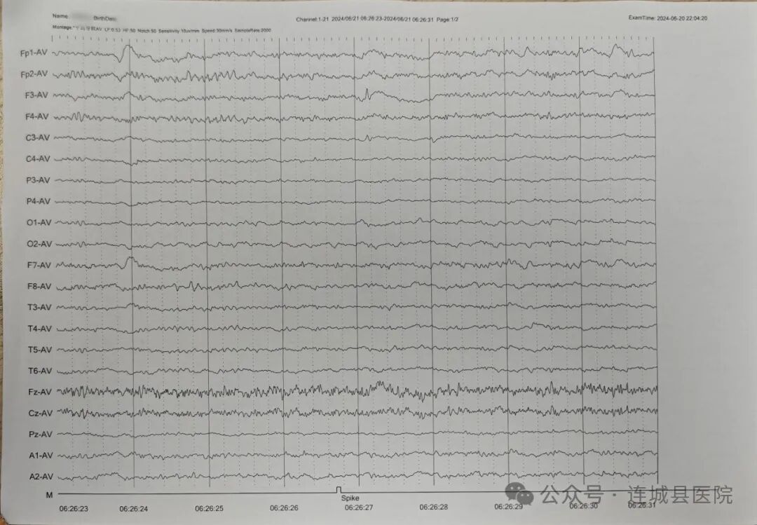 动态脑电图怎么看探索动态视频脑电图——洞察大脑的神秘电波_https://www.jmylbn.com_新闻资讯_第8张