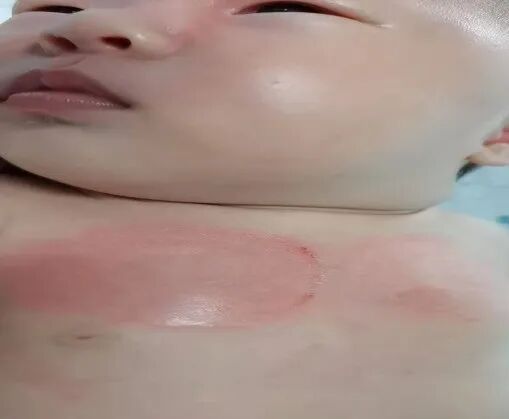 怎么撕敷料啊水胶体敷料的妙用，撕电极片时宝宝不再哭了！_https://www.jmylbn.com_新闻资讯_第4张