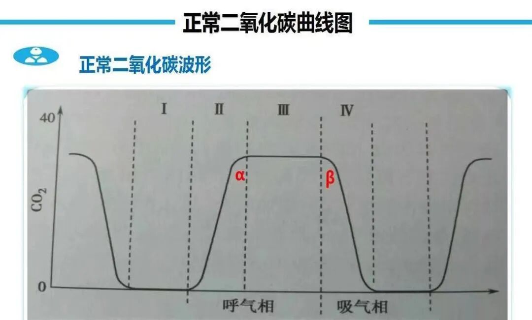 什么是呼吸麻醉临床麻醉｜静脉麻醉下监护呼吸末二氧化碳_https://www.jmylbn.com_新闻资讯_第3张
