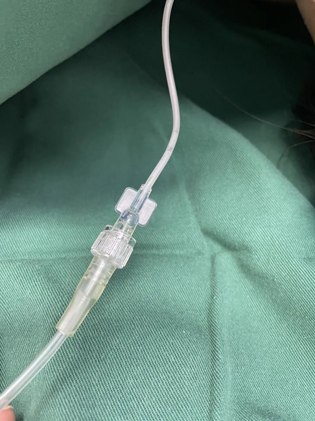 什么是呼吸麻醉临床麻醉｜静脉麻醉下监护呼吸末二氧化碳_https://www.jmylbn.com_新闻资讯_第5张