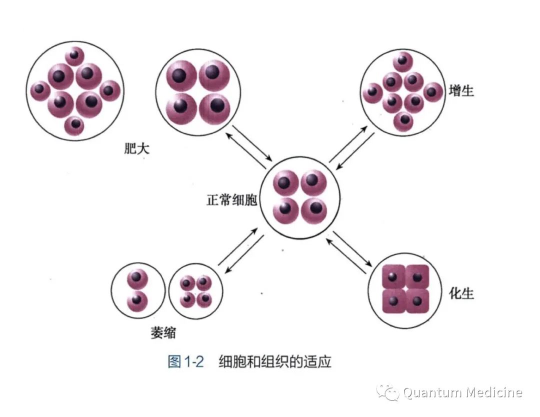 病理学之细胞和组织的适应与损伤（一）