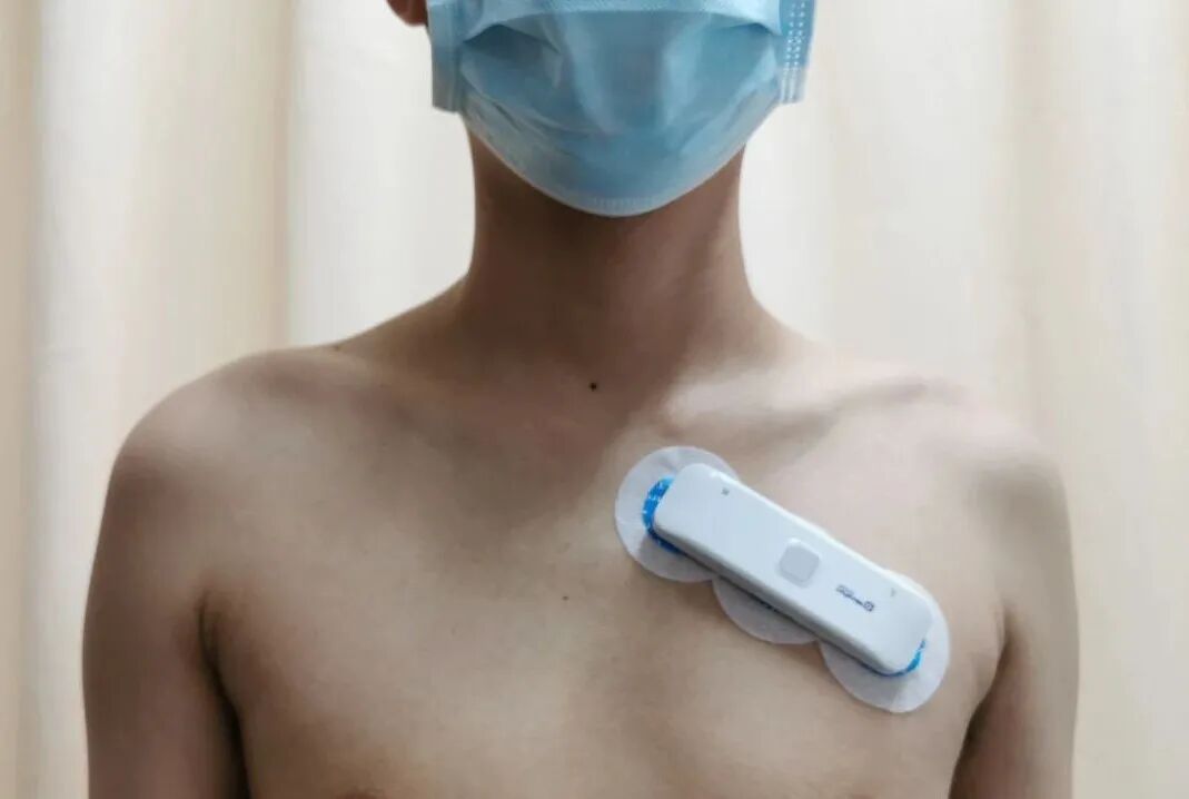 动态心电图仪器怎么看7天长时程动态心电图——您的心脏“记录仪”_https://www.jmylbn.com_新闻资讯_第4张