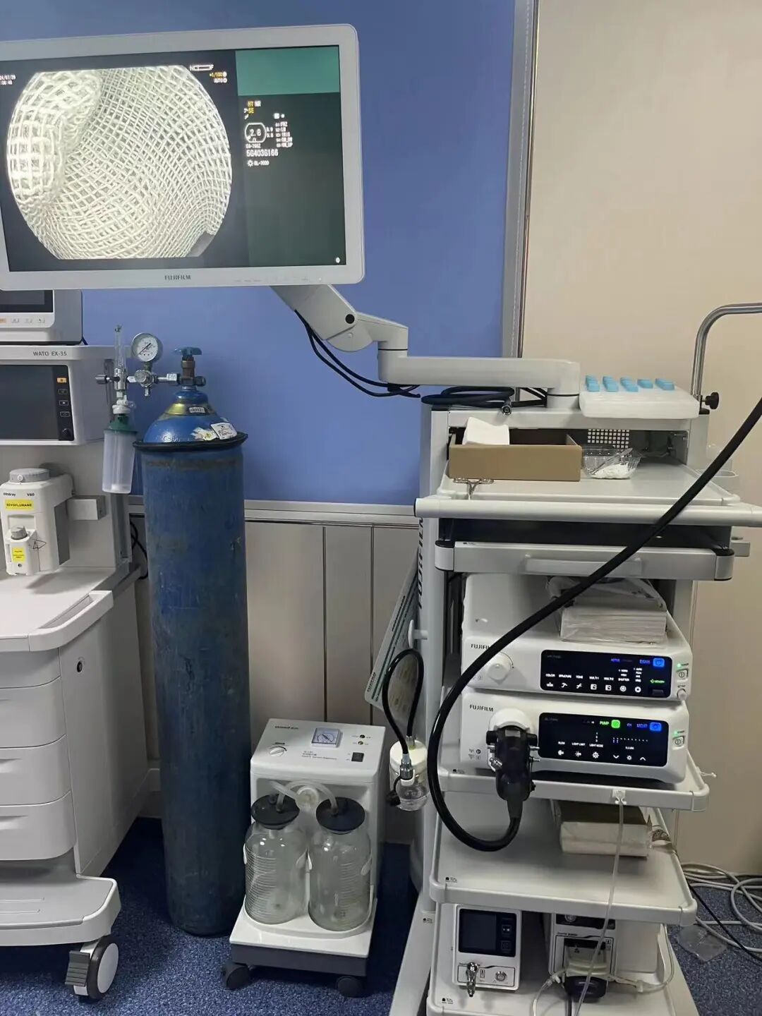 olympus胃肠镜怎么调试内镜中的“福尔摩斯”｜我院奥林巴斯（Olympus X1）富士ELUXEO 7000内镜系统投入使用_https://www.jmylbn.com_新闻资讯_第2张